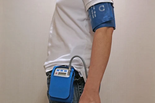 24-Hour Blood Pressure Monitoring